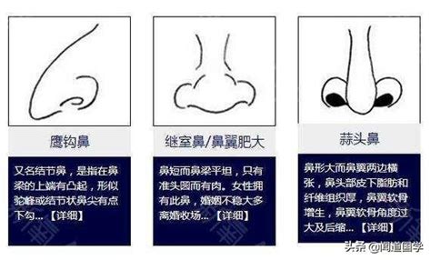 鼻樑生暗瘡面相|鼻相分析10款｜鼻樑有節及橫紋、豬膽鼻、鼻頭下垂代 